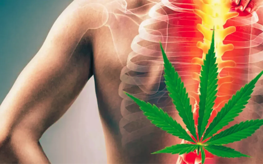 Cannabis For Pain Management: What You Should Know